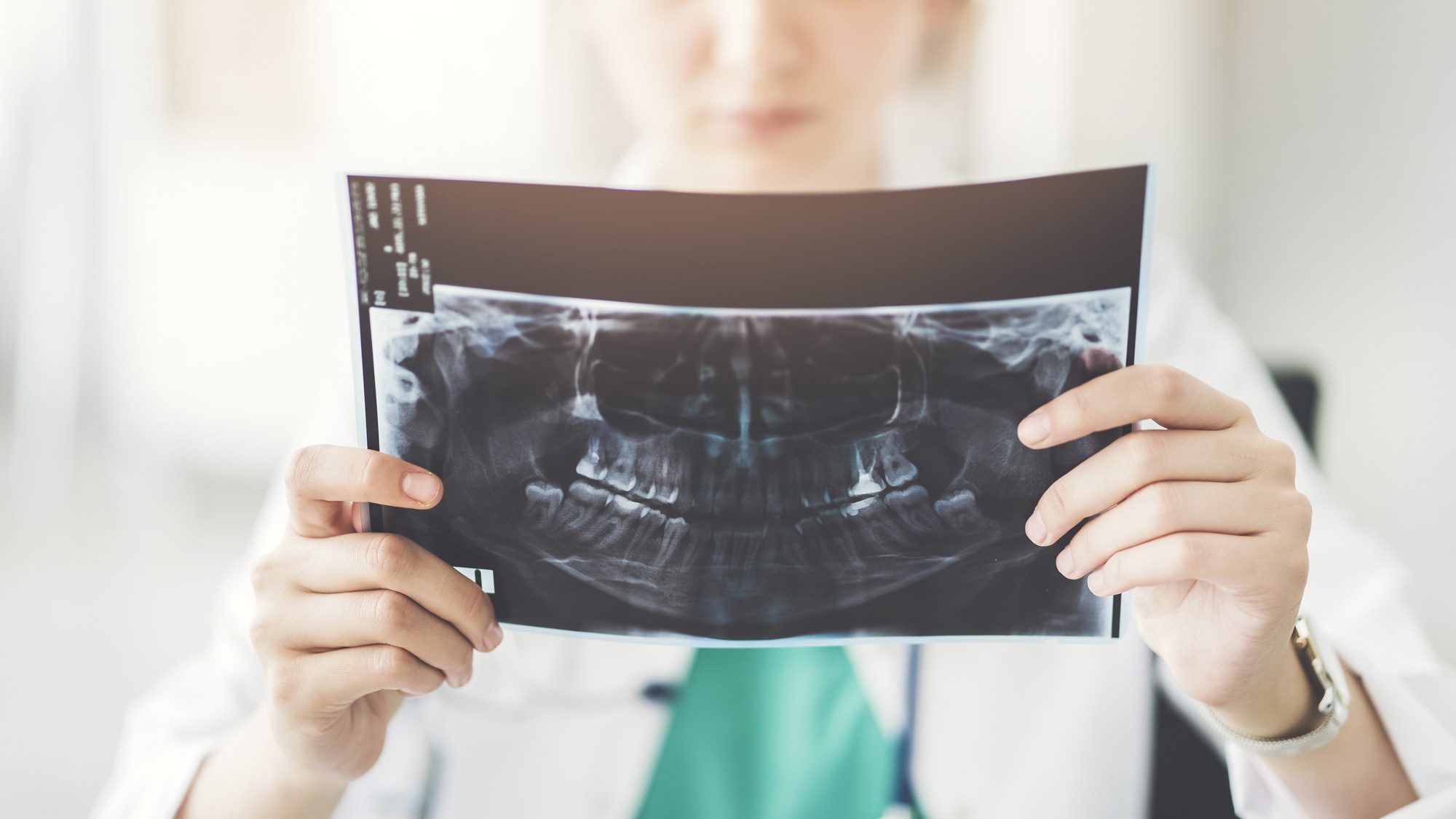 Dentist looking at xray